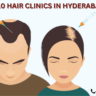 Top 10 Hair Clinics in Hyderabad
